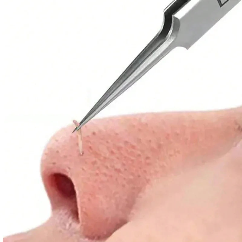 Blemish Kit