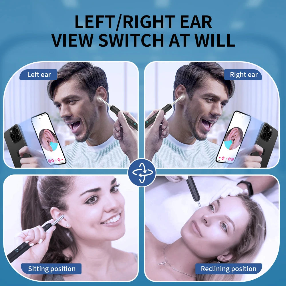 Wireless Ear Camera