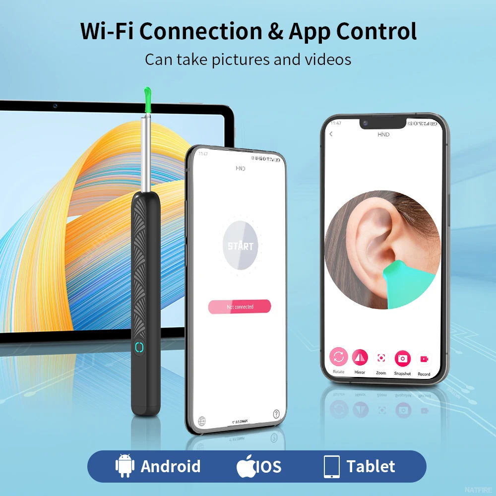 Wireless Ear Camera