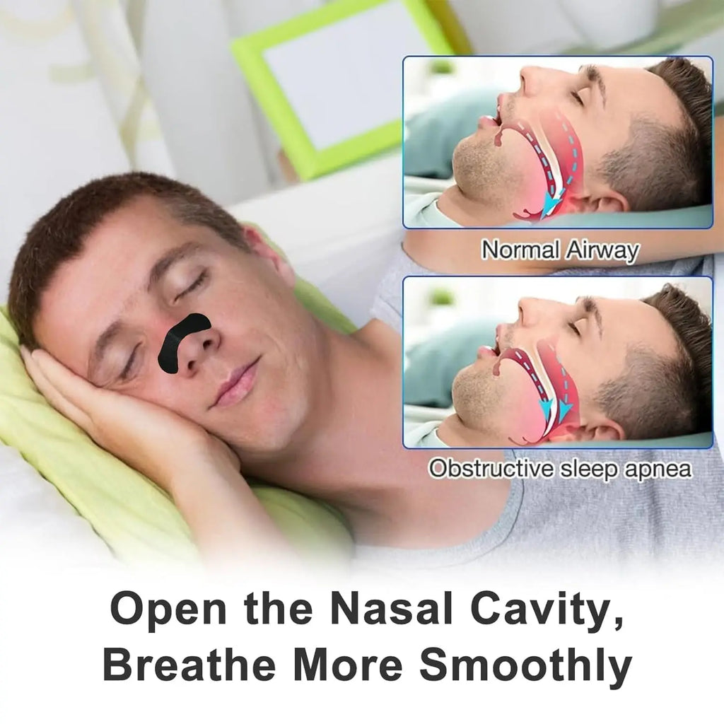 Nasal Strips