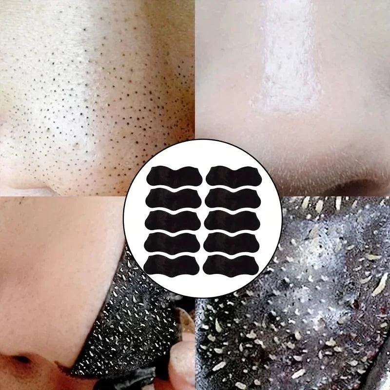 Nose Pore Strips