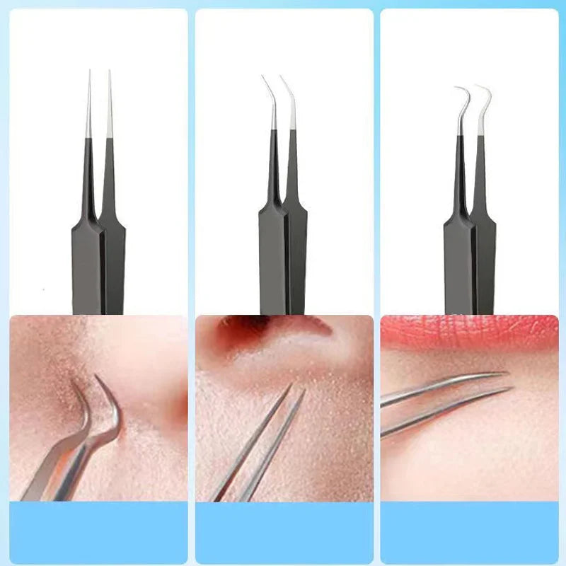 Blemish Kit