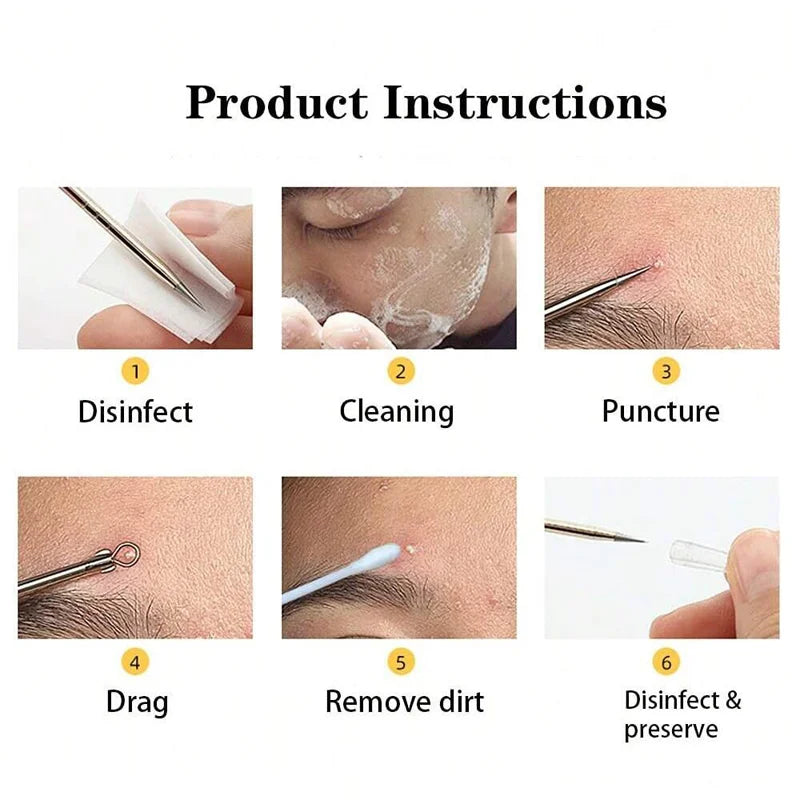 Blemish Kit